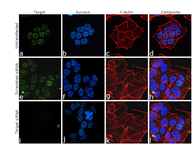 AP2 gamma Antibody in Immunocytochemistry (ICC/IF)