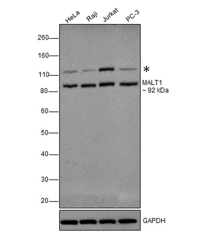 MALT1 Antibody in Western Blot (WB)