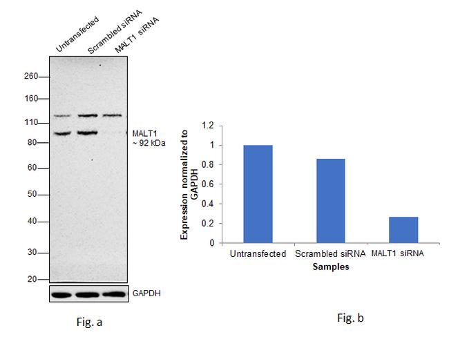 MALT1 Antibody in Western Blot (WB)