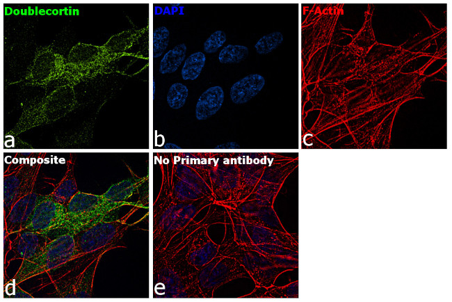 Doublecortin Antibody in Immunocytochemistry (ICC/IF)