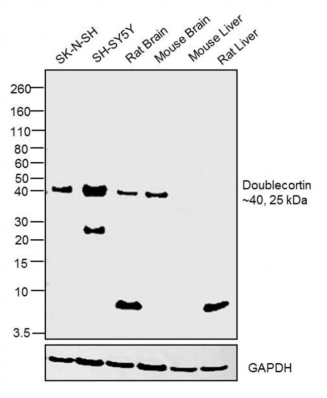 Doublecortin Antibody in Western Blot (WB)