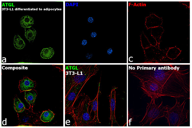 ATGL Antibody