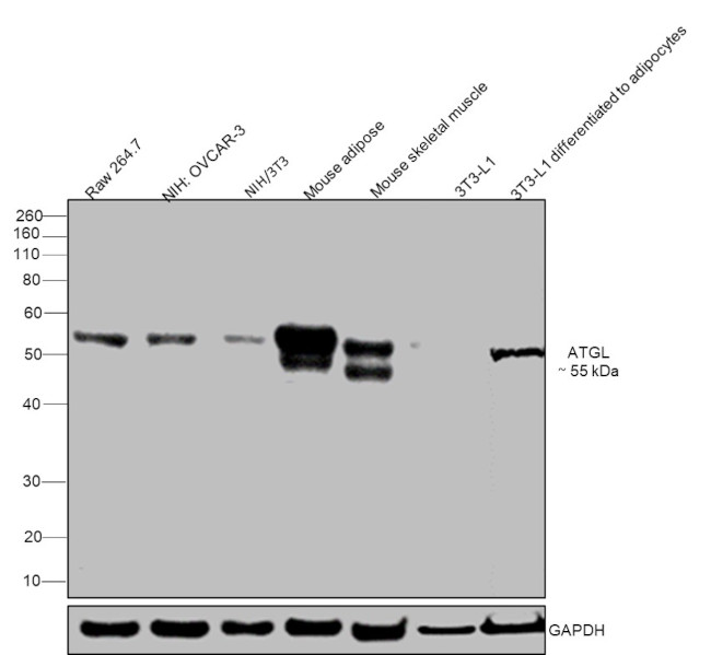 ATGL Antibody