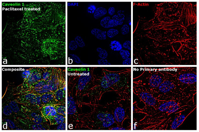 Caveolin 1 Antibody in Immunocytochemistry (ICC/IF)