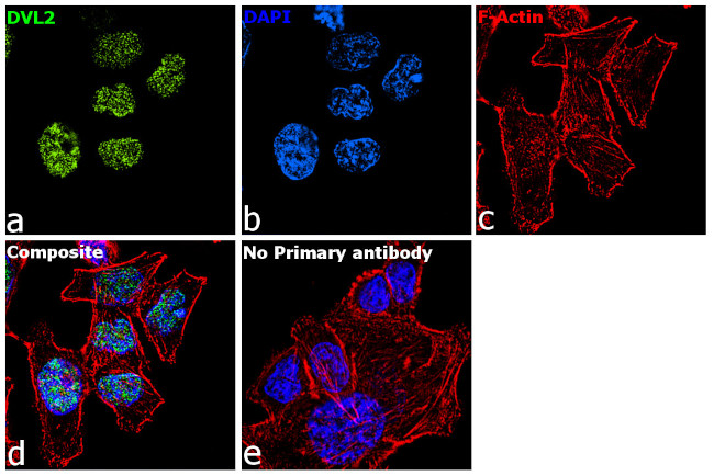 DVL2 Antibody in Immunocytochemistry (ICC/IF)