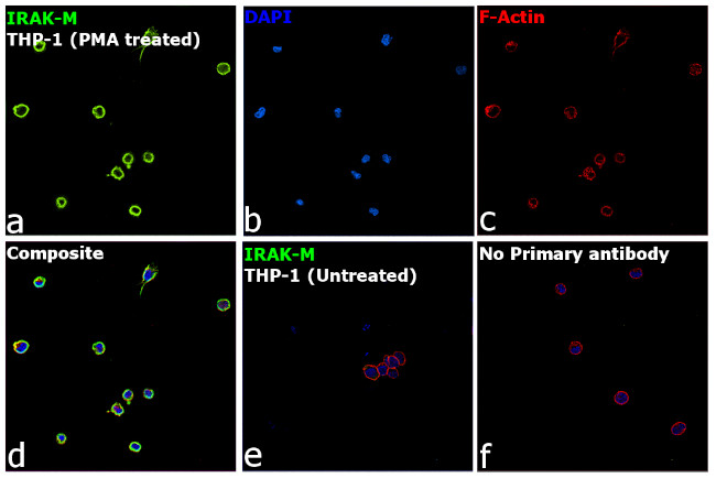 IRAK-M Antibody