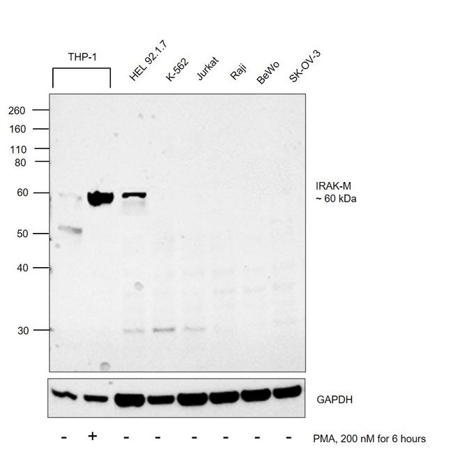 IRAK-M Antibody in Western Blot (WB)