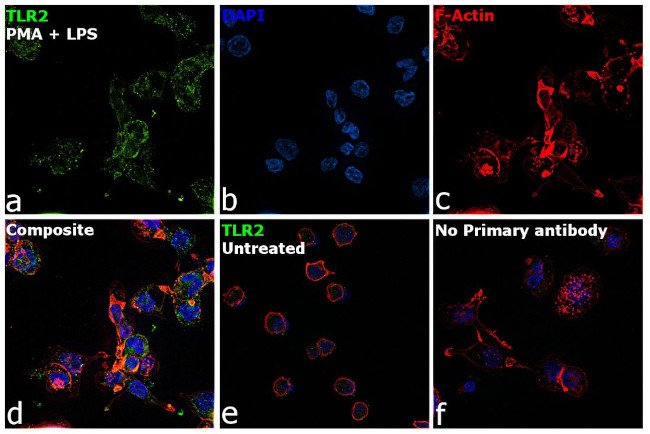 TLR2 Antibody in Immunocytochemistry (ICC/IF)