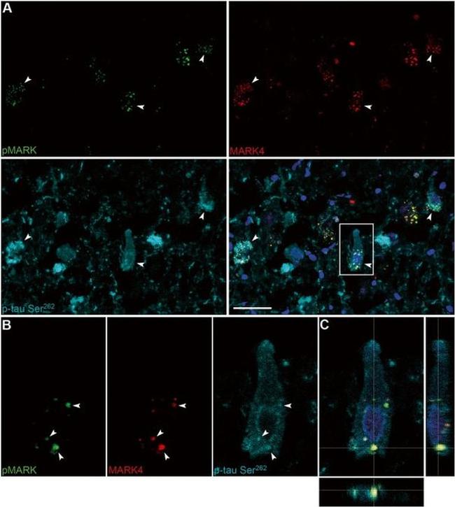 Phospho-MARK1/MARK2/MARK3 (Thr215, Thr208, Thr234) Antibody in Immunohistochemistry (IHC)