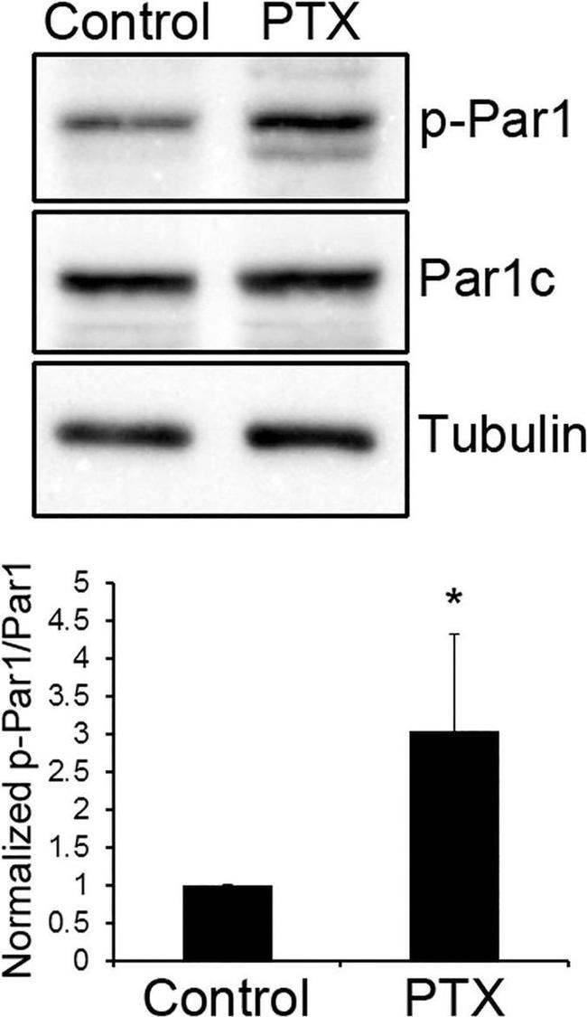 Phospho-MARK1/MARK2/MARK3 (Thr215, Thr208, Thr234) Antibody in Western Blot (WB)