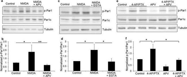 Phospho-MARK1/MARK2/MARK3 (Thr215, Thr208, Thr234) Antibody in Western Blot (WB)