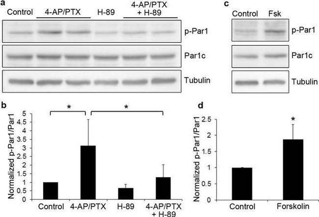 Phospho-MARK1/MARK2/MARK3 (Thr215, Thr208, Thr234) Antibody in Western Blot (WB)