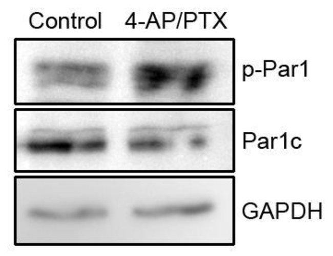 Phospho-MARK1/MARK2/MARK3 (Thr215, Thr208, Thr234) Antibody in Western Blot (WB)