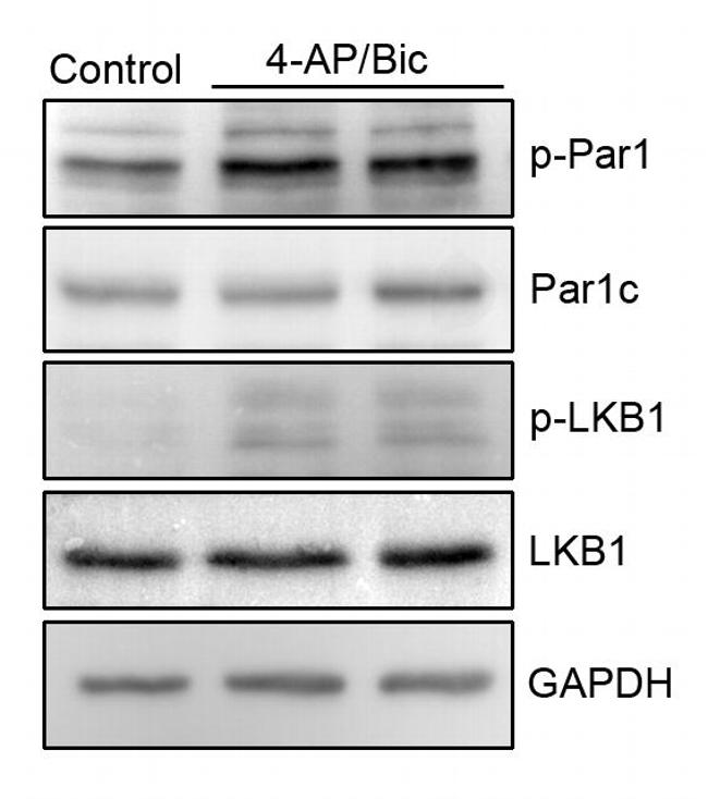 Phospho-MARK1/MARK2/MARK3 (Thr215, Thr208, Thr234) Antibody in Western Blot (WB)