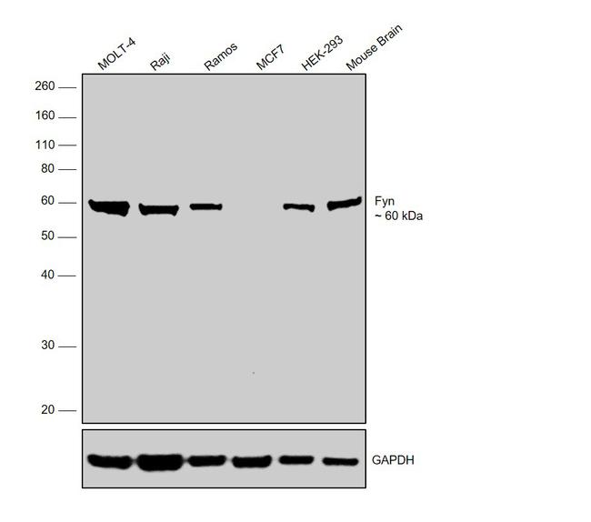 Fyn Antibody in Western Blot (WB)