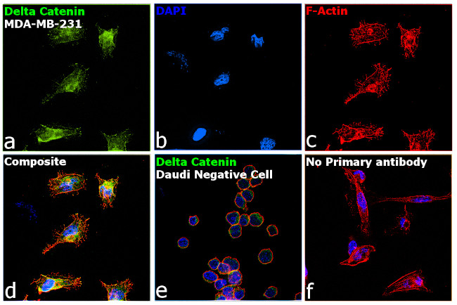 delta Catenin Antibody in Immunocytochemistry (ICC/IF)