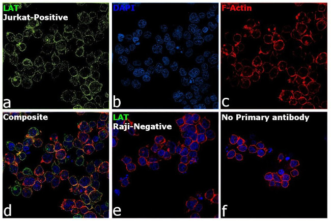 LAT Antibody in Immunocytochemistry (ICC/IF)