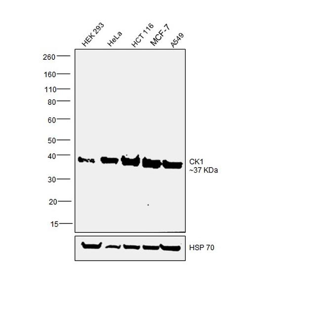 CK1 alpha Antibody in Western Blot (WB)