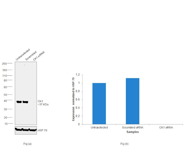 CK1 alpha Antibody