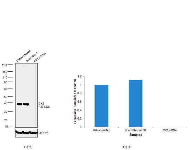 CK1 alpha Antibody in Western Blot (WB)