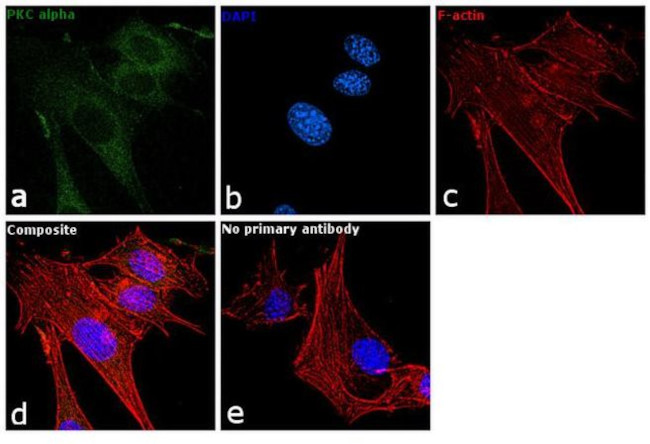 PKC alpha Antibody in Immunocytochemistry (ICC/IF)