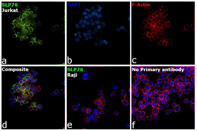 SLP76 Antibody in Immunocytochemistry (ICC/IF)