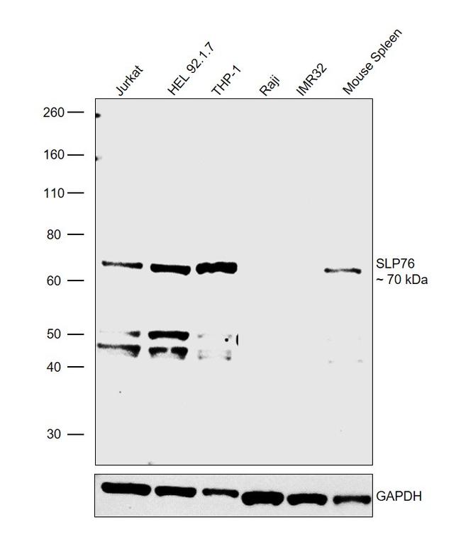 SLP76 Antibody in Western Blot (WB)