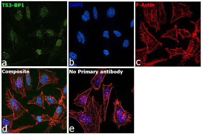 53BP1 Antibody in Immunocytochemistry (ICC/IF)