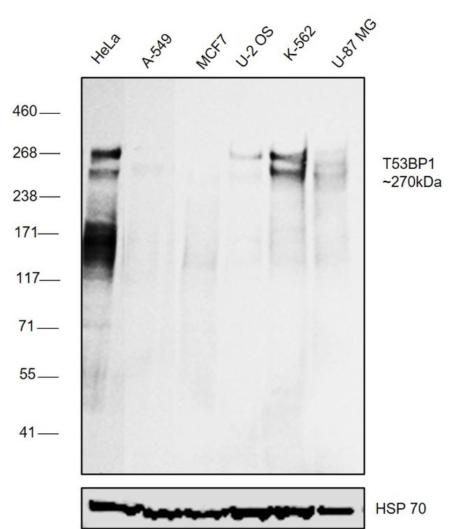 53BP1 Antibody in Western Blot (WB)