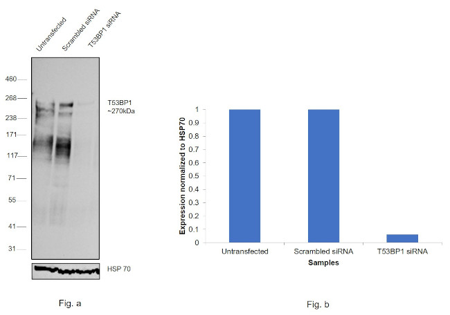 53BP1 Antibody