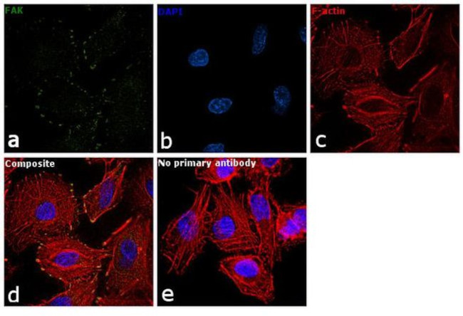 FAK Antibody in Immunocytochemistry (ICC/IF)