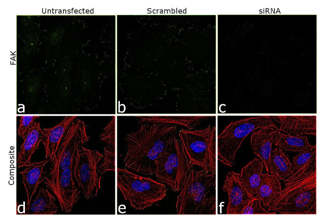 FAK Antibody in Immunocytochemistry (ICC/IF)