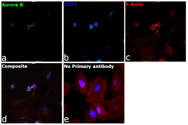 Aurora B Antibody in Immunocytochemistry (ICC/IF)