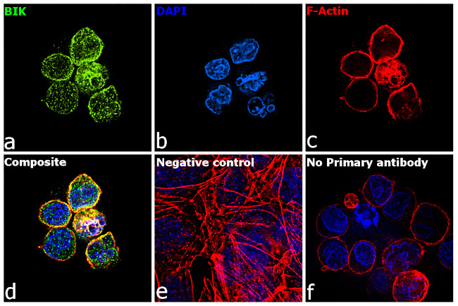 BIK Antibody in Immunocytochemistry (ICC/IF)