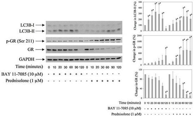 Phospho-Glucocorticoid Receptor (Ser211) Antibody in Western Blot (WB)