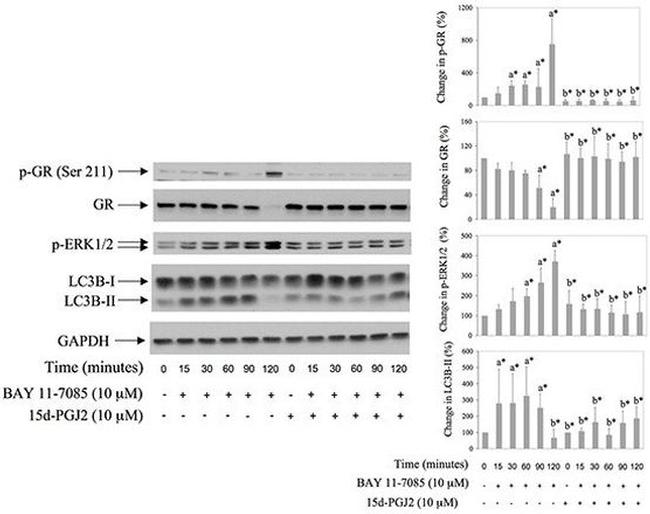 Phospho-Glucocorticoid Receptor (Ser211) Antibody in Western Blot (WB)