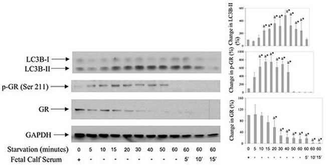 Phospho-Glucocorticoid Receptor (Ser211) Antibody in Western Blot (WB)