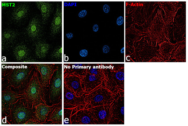 MST2 Antibody in Immunocytochemistry (ICC/IF)