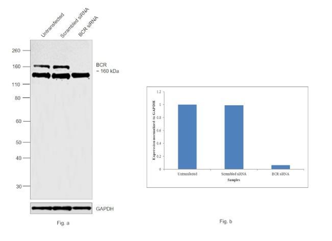 BCR Antibody in Western Blot (WB)