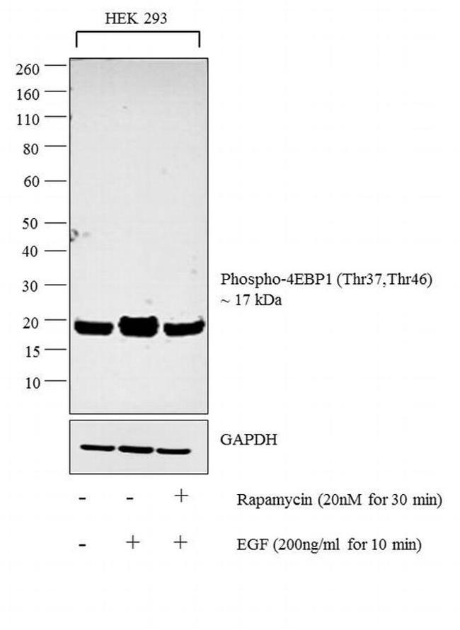 Phospho-4EBP1 (Thr37, Thr46) Antibody