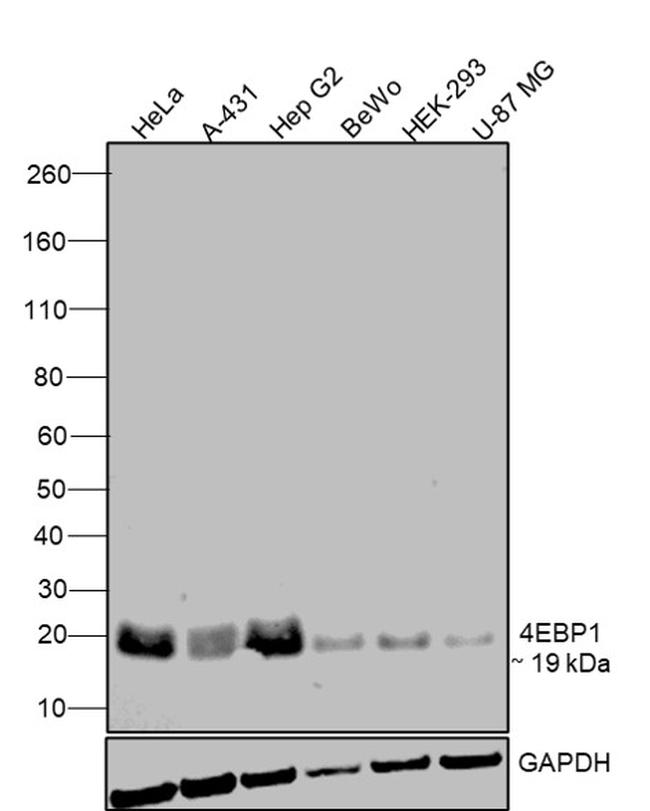 4EBP1 Antibody in Western Blot (WB)