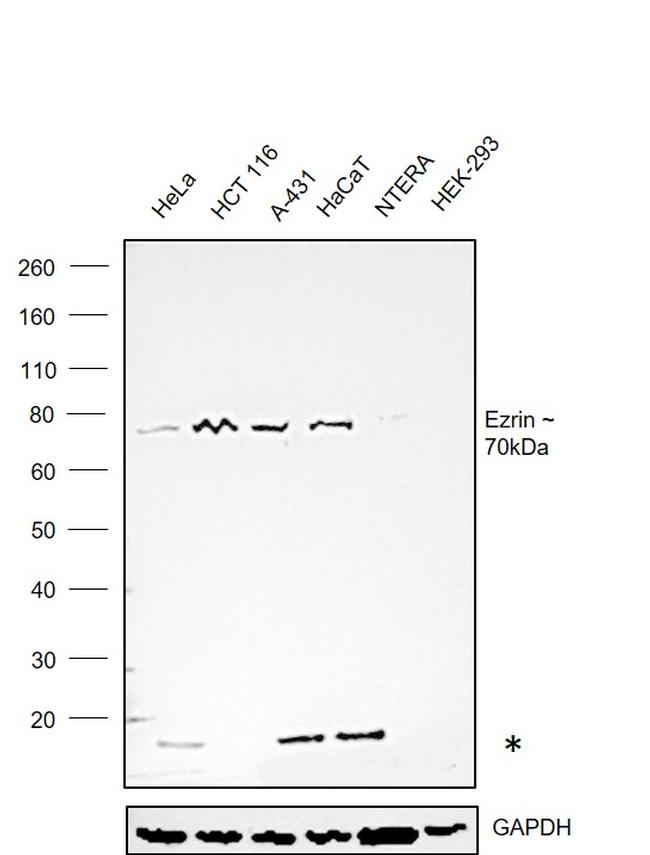 Ezrin Antibody in Western Blot (WB)