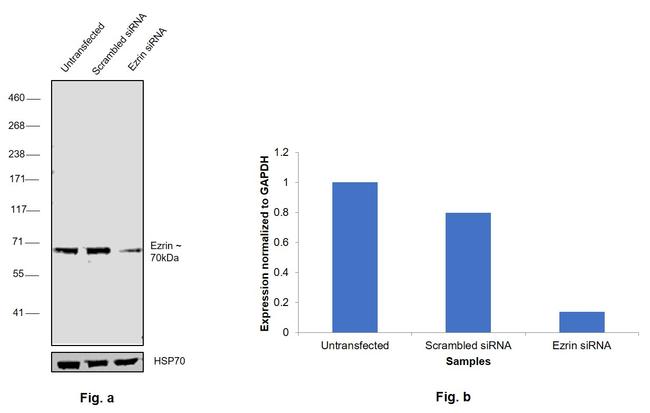 Ezrin Antibody in Western Blot (WB)