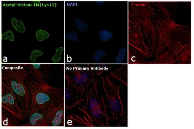 H4K12ac Antibody in Immunocytochemistry (ICC/IF)