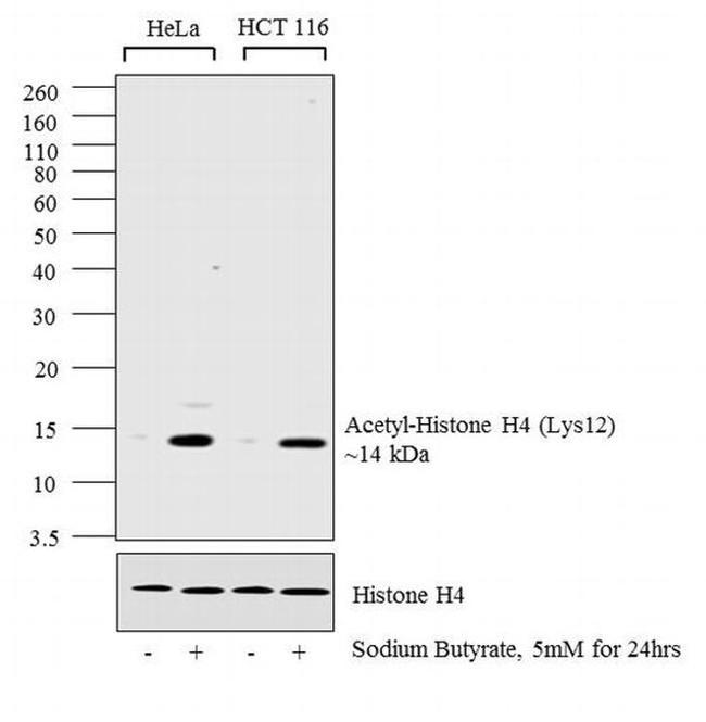 H4K12ac Antibody in Western Blot (WB)