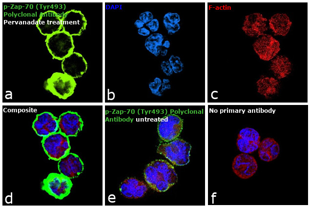 Phospho-Zap-70 (Tyr493) Antibody in Immunocytochemistry (ICC/IF)