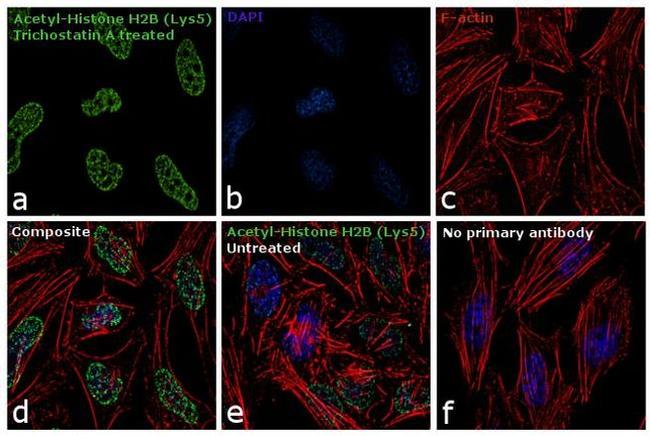 H2BK5ac Antibody