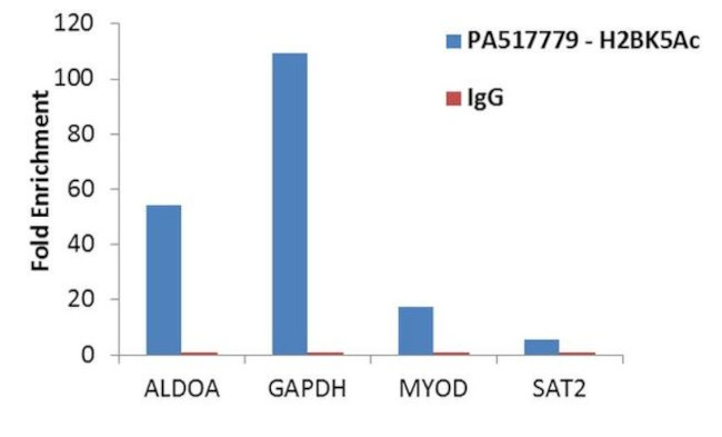 H2BK5ac Antibody in ChIP Assay (ChIP)