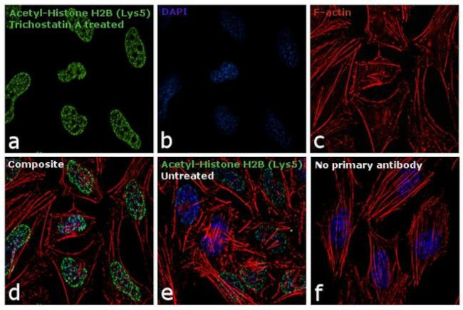 H2BK5ac Antibody in Immunocytochemistry (ICC/IF)