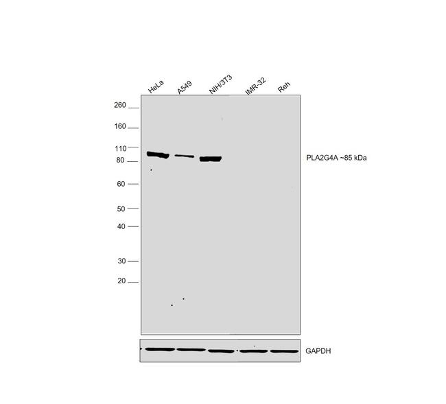Phospho-PLA2G4A (Ser505) Antibody in Western Blot (WB)
